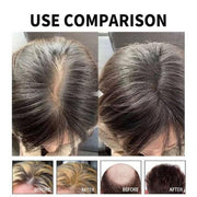 Hair Loss Treatment Serum 30Ml (Pack Of 1)